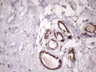 Immunohistochemistry: LIPT2-AS1 Antibody (OTI4C7) - Azide and BSA Free [NBP2-71949]