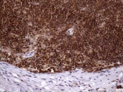 Immunohistochemistry: LIPT2-AS1 Antibody (OTI4C7) - Azide and BSA Free [NBP2-71949]