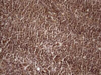 Immunohistochemistry: LIPT2-AS1 Antibody (OTI4C7) - Azide and BSA Free [NBP2-71949]