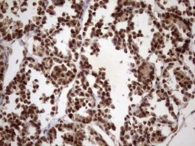 Immunohistochemistry: LIPT2-AS1 Antibody (OTI4C7) - Azide and BSA Free [NBP2-71949]