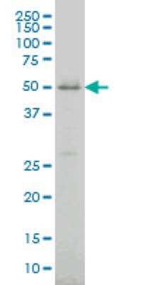 Western Blot: Cytochrome p450 2J2 Antibody (2D10) [H00001573-M01]