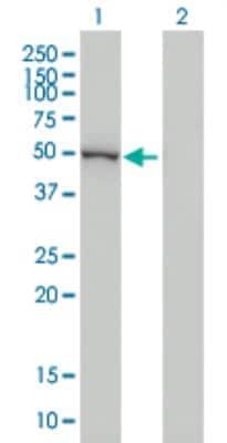 Western Blot: Cytochrome p450 2J2 Antibody (2D10) [H00001573-M01]