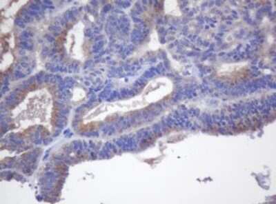 Immunohistochemistry: Cytochrome p450 2J2 Antibody (OTI5C9) [NBP2-46419]