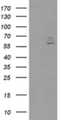 Western Blot: Cytochrome p450 2J2 Antibody (OTI5C9) [NBP2-46419]