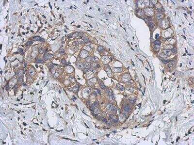 Immunohistochemistry-Paraffin: Cytochrome p450 2J2 Antibody [NBP2-16079]