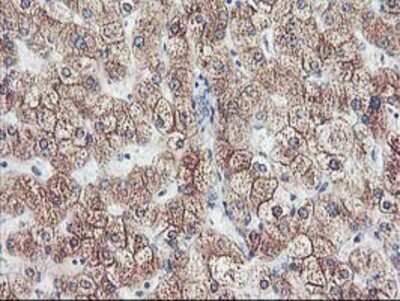 Immunohistochemistry: Cytochrome p450 2J2 Antibody (OTI5C5) - Azide and BSA Free [NBP2-70539]
