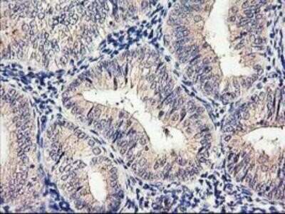 Immunohistochemistry-Paraffin: Cytochrome p450 2J2 Antibody (OTI5C5) [NBP2-01286]