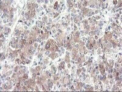Immunohistochemistry-Paraffin: Cytochrome p450 2J2 Antibody (OTI5C5) [NBP2-01286]