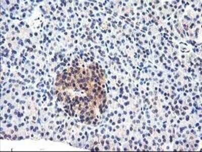 Immunohistochemistry-Paraffin: Cytochrome p450 2J2 Antibody (OTI5C5) [NBP2-01286]