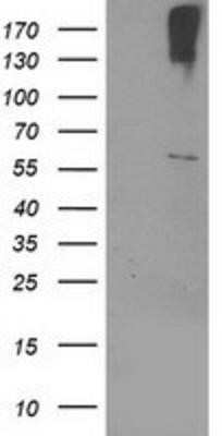 Western Blot: Cytochrome p450 2J2 Antibody (OTI5C5) [NBP2-01286]