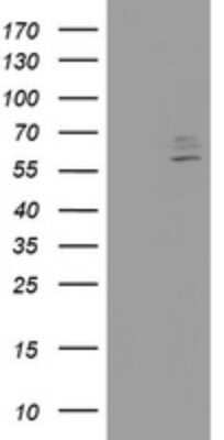 Western Blot: Cytochrome p450 2J2 Antibody (OTI5C9)Azide and BSA Free [NBP2-70533]