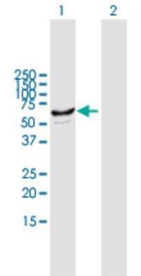 Western Blot: Cytochrome p450 2J2 Antibody [H00001573-B01P]