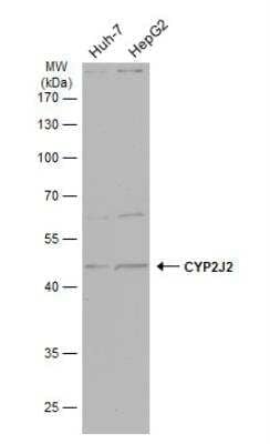 Western Blot: Cytochrome p450 2J2 Antibody [NBP2-16079]