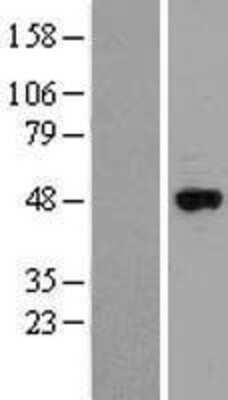 Western Blot: Cytochrome p450 2J2 Overexpression Lysate [NBL1-09688]