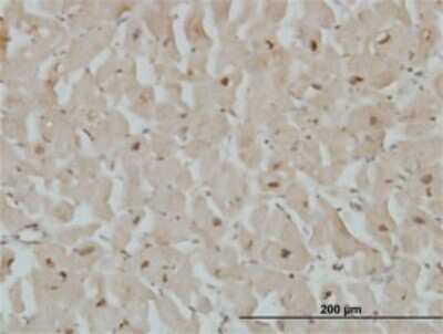 Immunohistochemistry-Paraffin: Cytoglobin Antibody (1A1) [H00114757-M02]