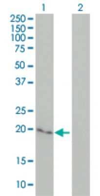 Western Blot: Cytoglobin Antibody (1A1) [H00114757-M02]