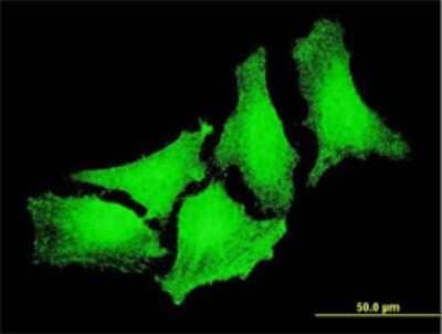 Immunocytochemistry/ Immunofluorescence: Cytoglobin Antibody (3A5-2D2) [H00114757-M01]