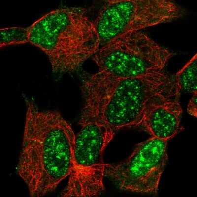 Immunocytochemistry/ Immunofluorescence: Cytoglobin Antibody [NBP2-55897]