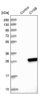 Western Blot: Cytoglobin Antibody [NBP1-89701]