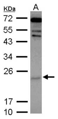 Western Blot: Cytoglobin Antibody [NBP2-16084]