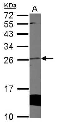 Western Blot: Cytoglobin Antibody [NBP2-16084]