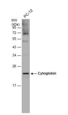 Western Blot: Cytoglobin Antibody [NBP2-16084]