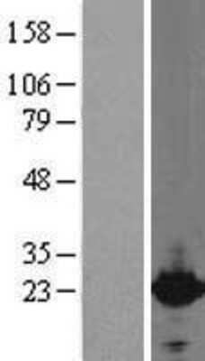 Western Blot: Cytoglobin Overexpression Lysate [NBL1-09664]