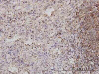 Immunohistochemistry-Paraffin: Cytohesin-1 Antibody (1D6) [H00009267-M01]