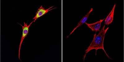 Immunocytochemistry/ Immunofluorescence: Cytohesin-1 Antibody (2E11) [NBP2-22512]