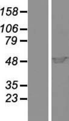 Western Blot: Cytohesin-1 Overexpression Lysate [NBP2-10540]