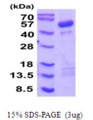 SDS-PAGE: Recombinant Human Cytohesin-1 His Protein [NBP2-52108]