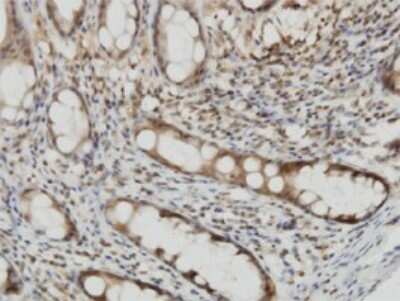 Immunohistochemistry-Paraffin: Cytohesin 2 Antibody (6H5) [H00009266-M02]