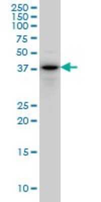 Western Blot: Cytohesin 2 Antibody (6H5) [H00009266-M02]