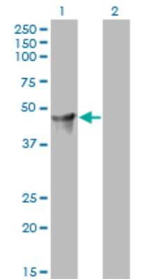 Western Blot: Cytohesin 2 Antibody (6H5) [H00009266-M02]
