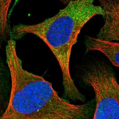 Immunocytochemistry/ Immunofluorescence: Cytohesin 2 Antibody [NBP2-68764]