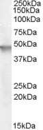 Western Blot: Cytohesin 2 Antibody [NB100-77340]