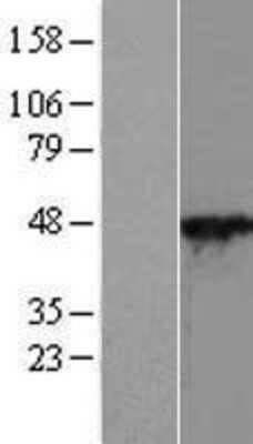 Western Blot: Cytohesin 2 Overexpression Lysate [NBL1-14857]