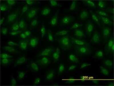 Immunocytochemistry/ Immunofluorescence: Cytohesin 3 Antibody (6D3-1A9) [H00009265-M01]