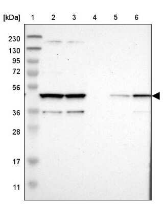 Western Blot: Cytohesin 3 Antibody [NBP1-90097]