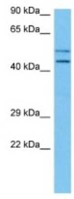 Western Blot: Cytohesin 3 Antibody [NBP3-10863]