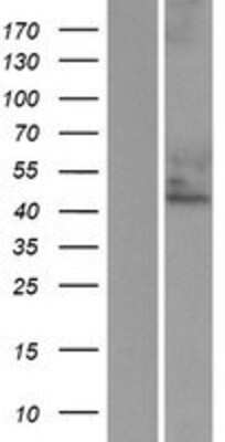 Western Blot: Cytohesin 3 Overexpression Lysate [NBP2-10577]