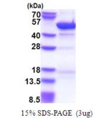 SDS-PAGE: Recombinant Human Cytohesin 3 His Protein [NBP2-51671]