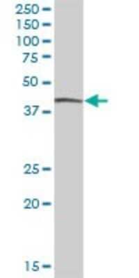 Western Blot: Cytohesin 4 Antibody [H00027128-B01P]