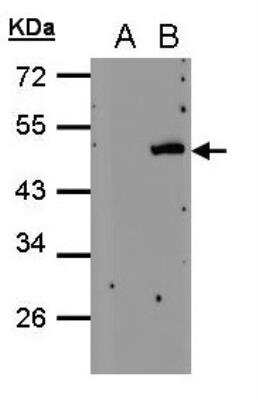 Western Blot: Cytohesin 4 Antibody [NBP2-19974]