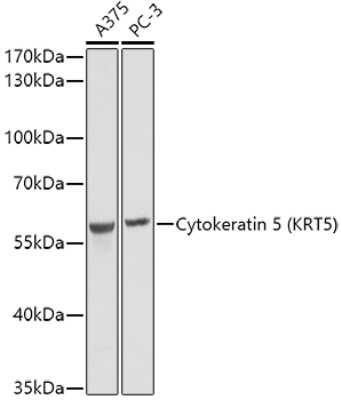 Western Blot: Cytokeratin 5 AntibodyAzide and BSA Free [NBP2-92884]