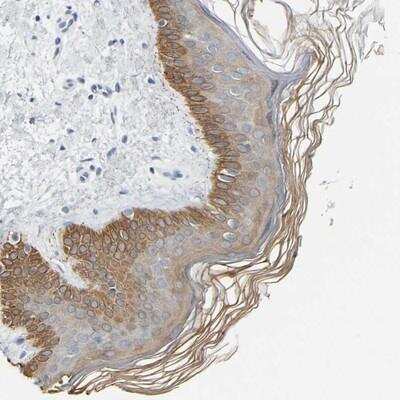 Immunohistochemistry-Paraffin: Cytokeratin, HMW Antibody [NBP1-81647]