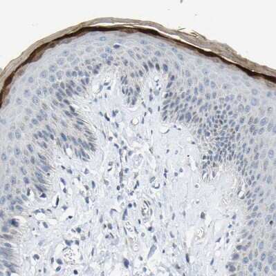 Immunohistochemistry-Paraffin: Cytokeratin, HMW Antibody [NBP1-81648]