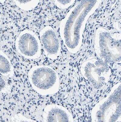 Immunohistochemistry-Paraffin: Cytokeratin, HMW Antibody [NBP1-81648]