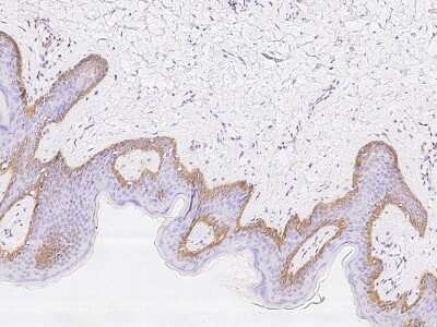 Immunohistochemistry-Paraffin: Cytokeratin, HMW Antibody [NBP2-97591]