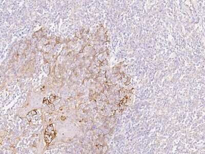 Immunohistochemistry-Paraffin: Cytokeratin, HMW Antibody [NBP2-97591]